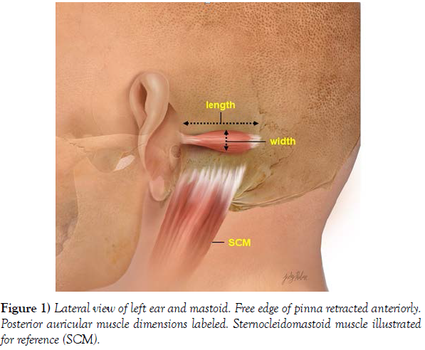 international-journal-anatomical-variations-Lateral