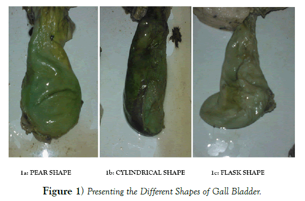 international-journal-anatomical-variations-Shapes