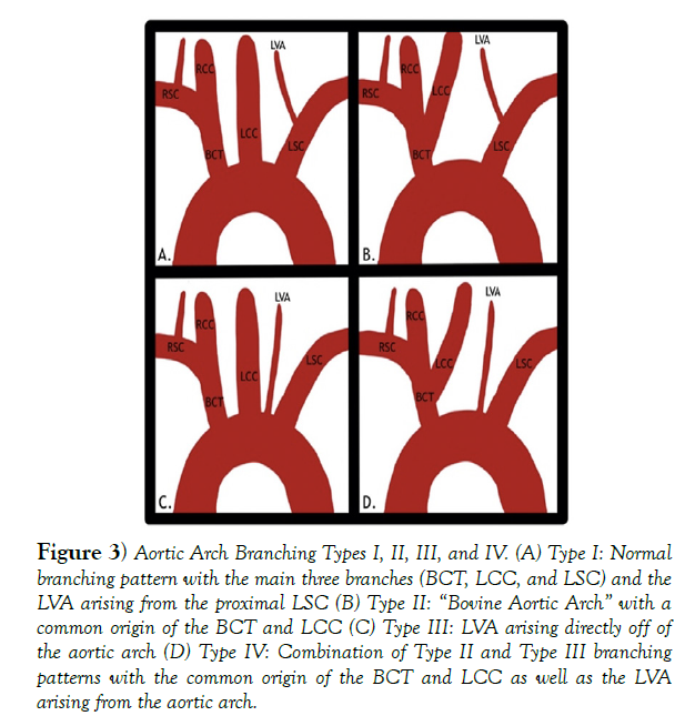 international-journal-anatomical-variations-Types