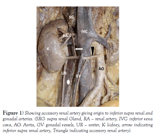 international-journal-anatomical-variations-accessory
