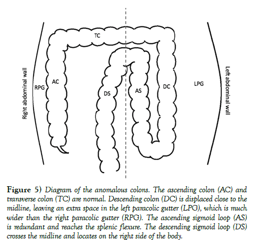 international-journal-anatomical-variations-anomalous