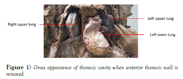 international-journal-anatomical-variations-anterior