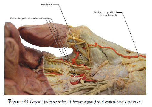 international-journal-anatomical-variations-aspect