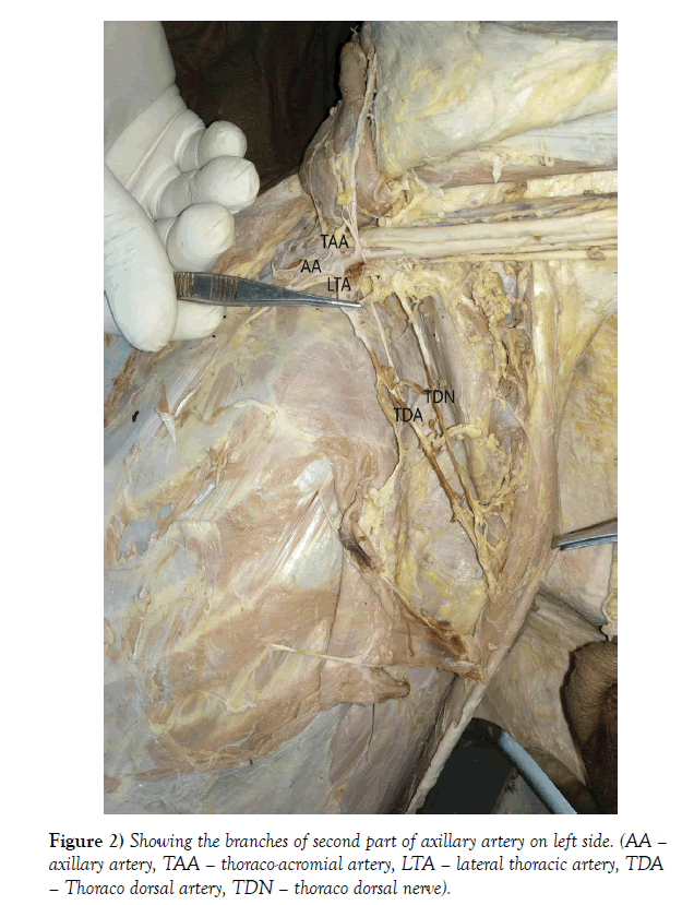 international-journal-anatomical-variations-axillary