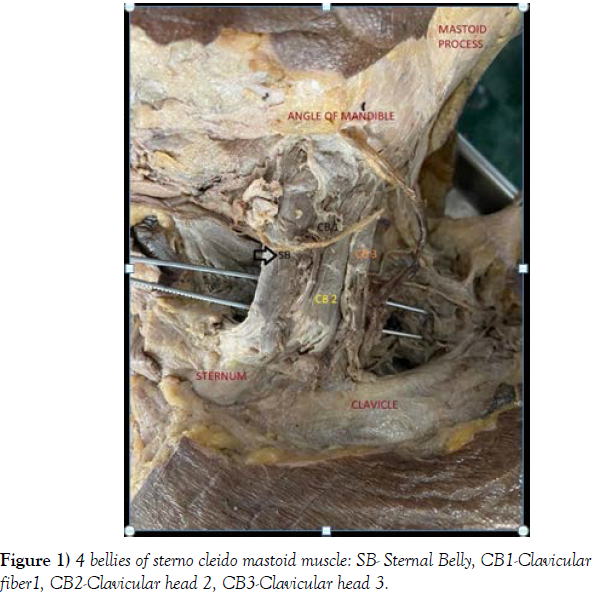 international-journal-anatomical-variations-bellies