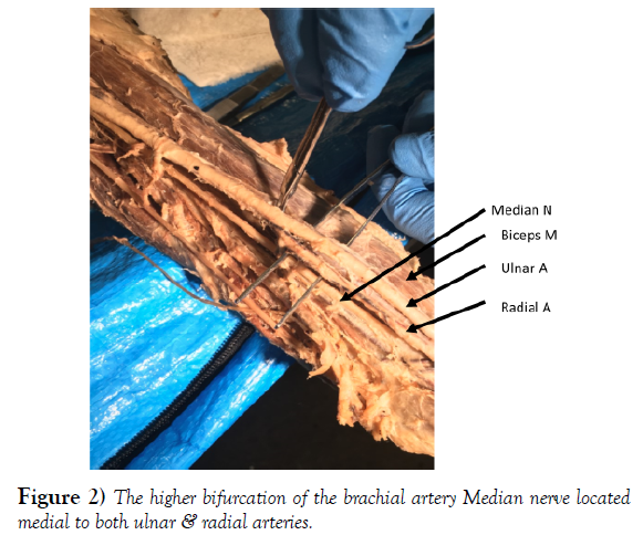 international-journal-anatomical-variations-brachial