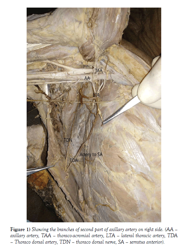 international-journal-anatomical-variations-branches