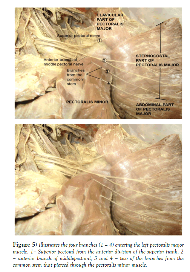 international-journal-anatomical-variations-branches