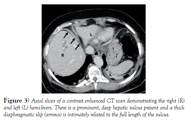 international-journal-anatomical-variations-contrast