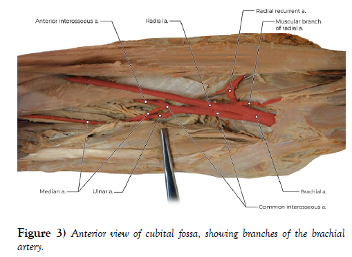 international-journal-anatomical-variations-cubital