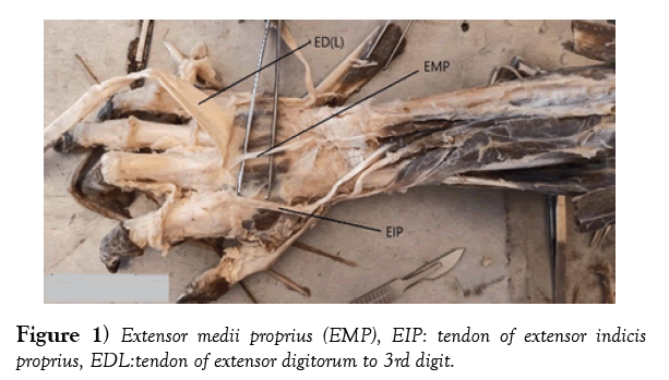 international-journal-anatomical-variations-digitorum