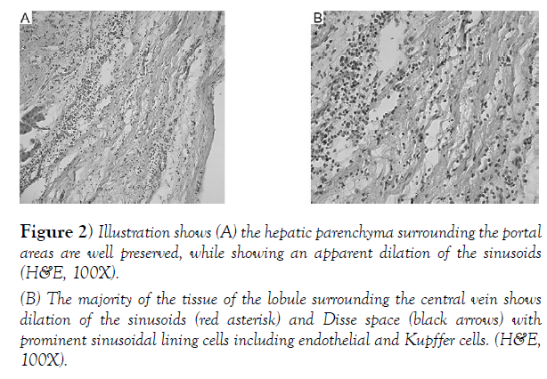 international-journal-anatomical-variations-dilation