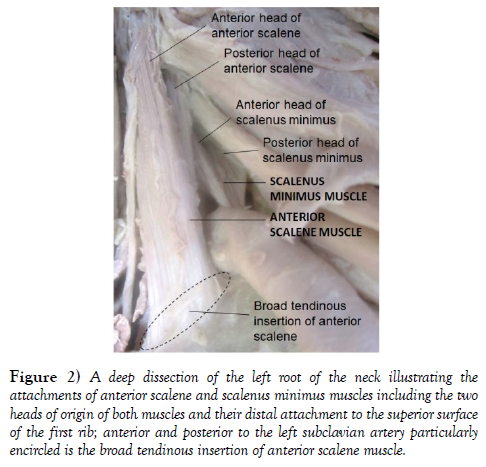 international-journal-anatomical-variations