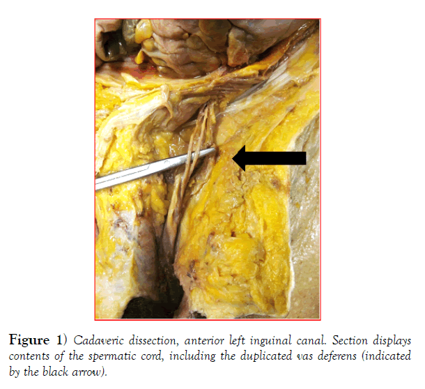 international-journal-anatomical-variations-dissection