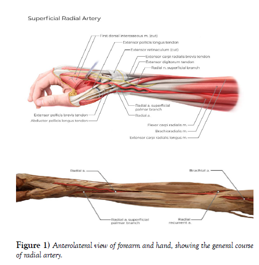 international-journal-anatomical-variations-forearm