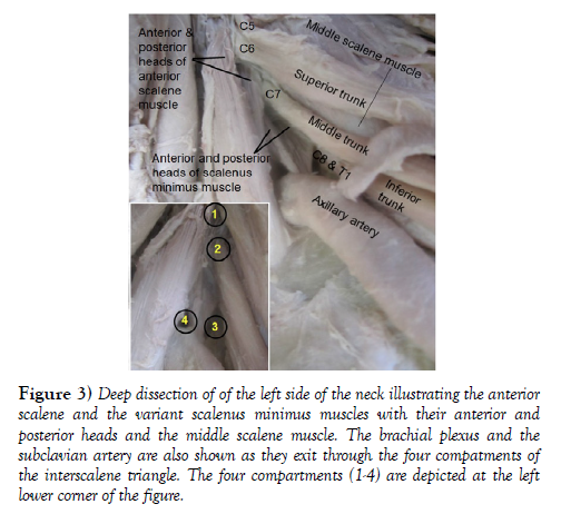 international-journal-anatomical-variations