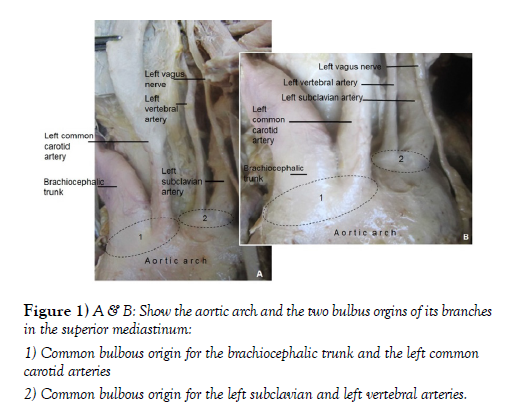 international-journal-anatomical-variations