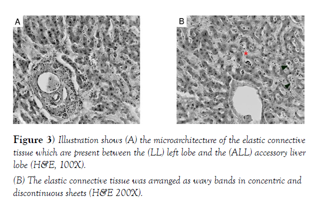 international-journal-anatomical-variations-microarchitecture