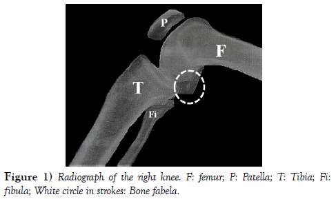 international-journal-anatomical-variations-radiograph