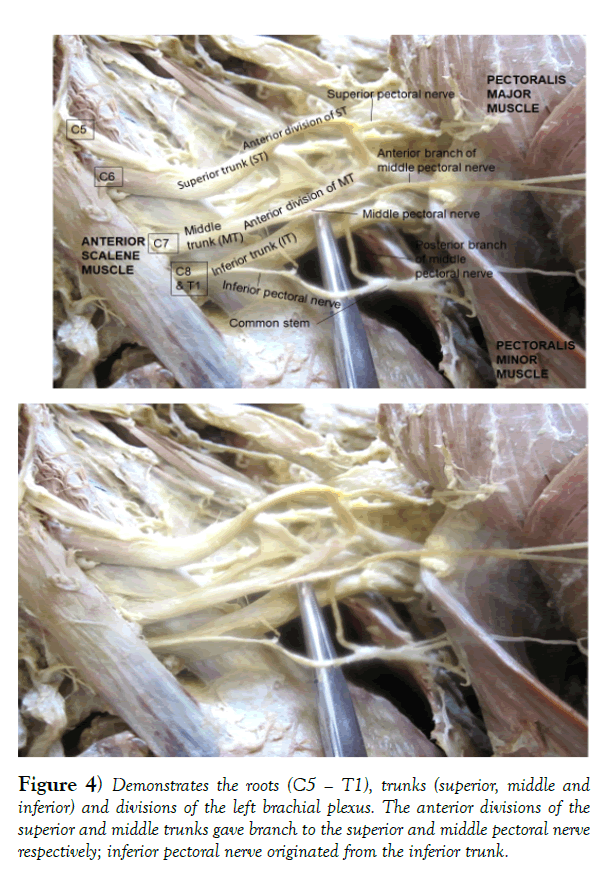 international-journal-anatomical-variations-roots