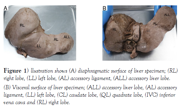 international-journal-anatomical-variations-surface