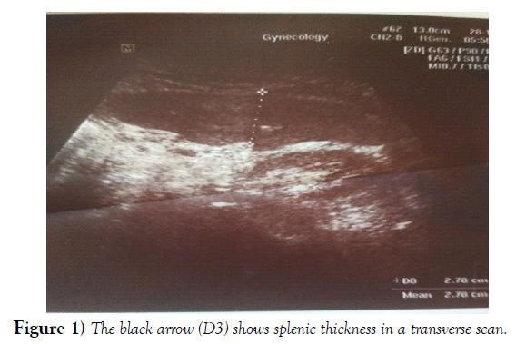 international-journal-anatomical-variations-thickness