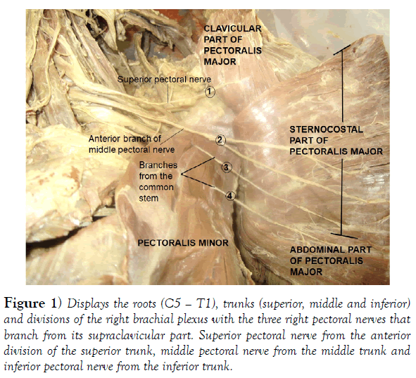international-journal-anatomical-variations-trunks