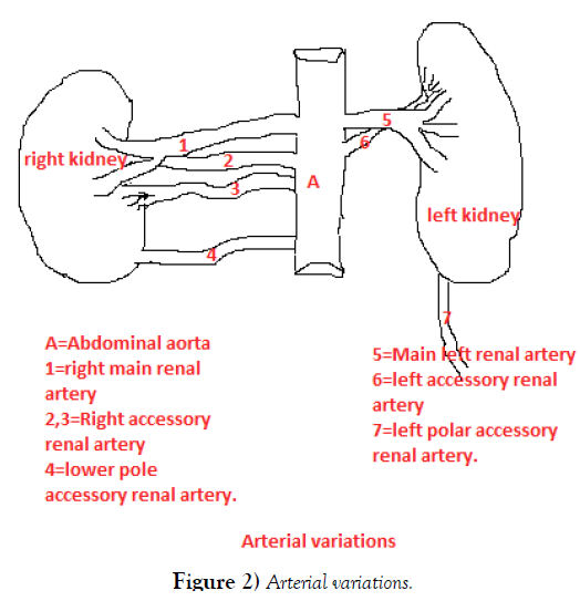 international-journal-anatomical-variations-variations