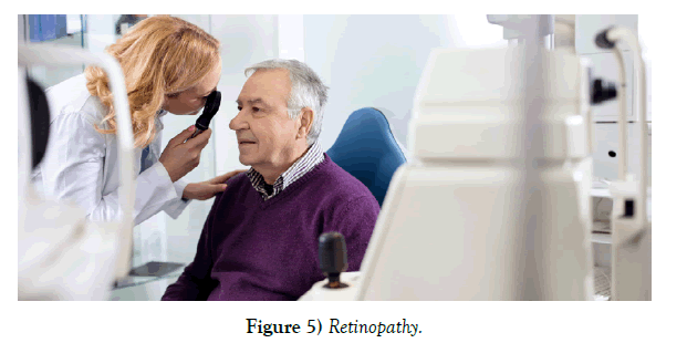 journal-pure-applied-mathematics-Retinopathy