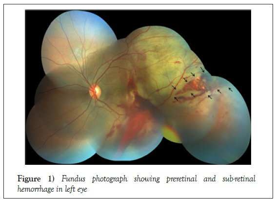 Fundus