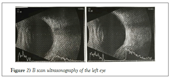 ultrasonography