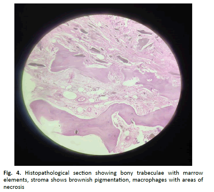 orthopaedics-trauma-brownish-pigmentation