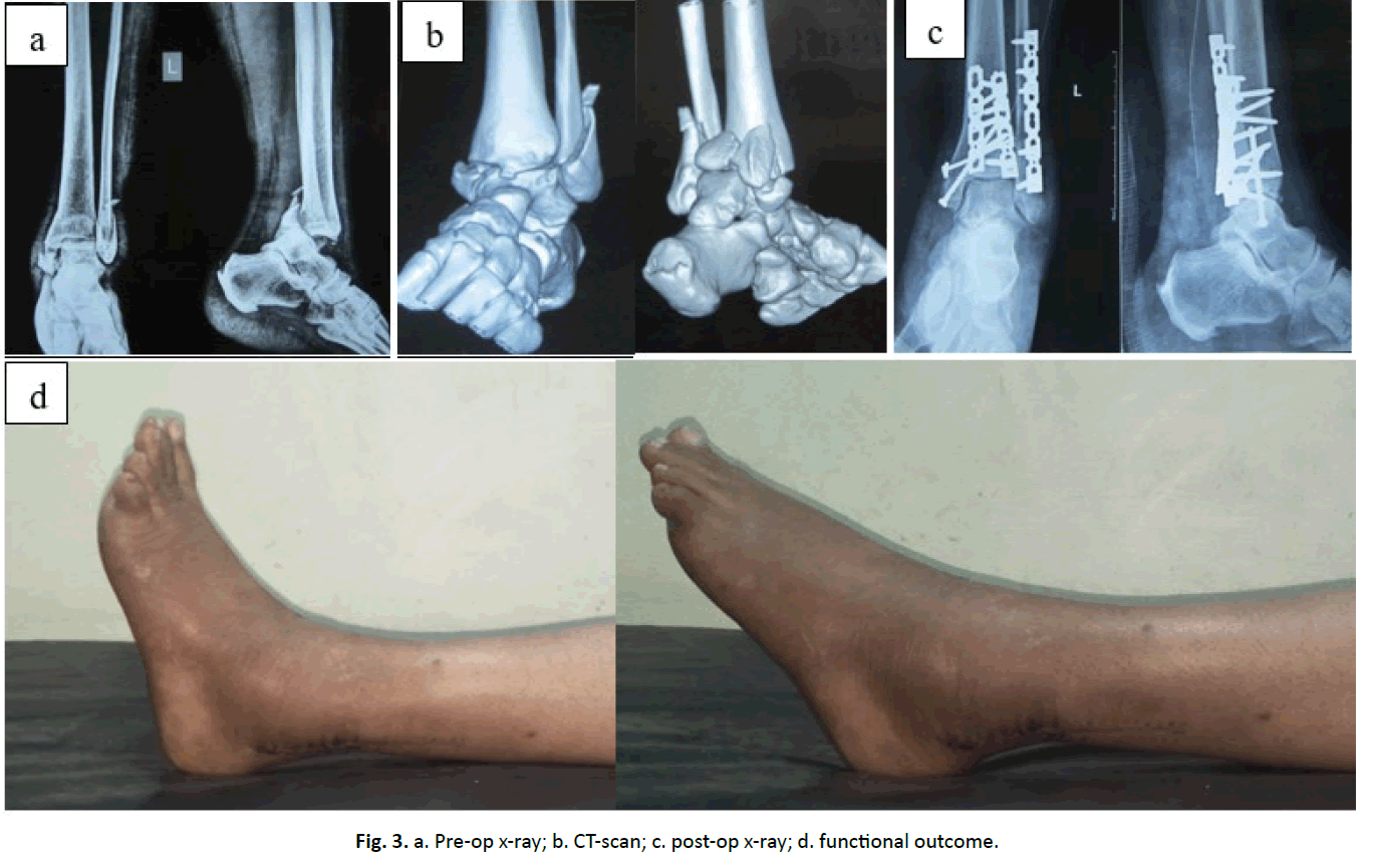 orthopaedics-trauma-functional-outcome