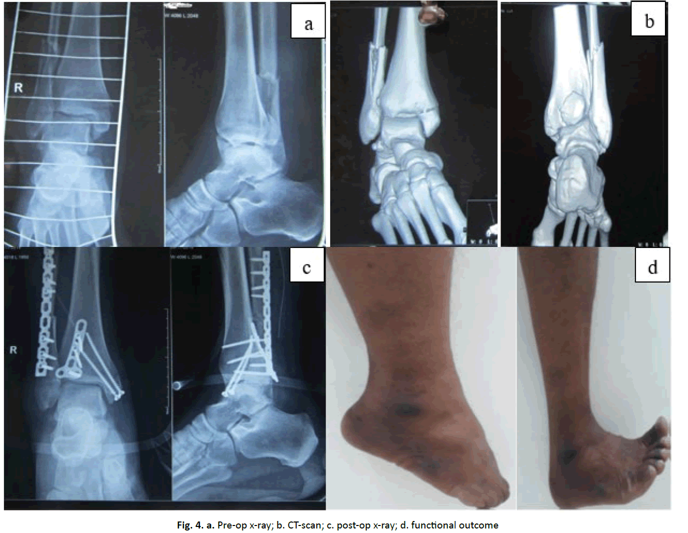 orthopaedics-trauma-functional-outcome