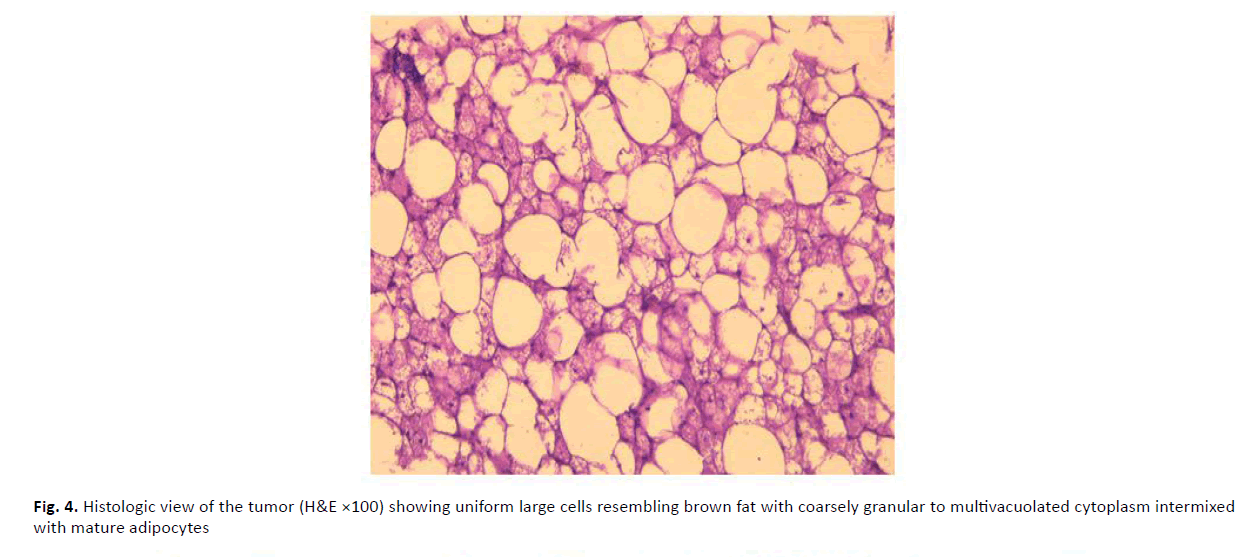 orthopaedics-trauma-large-cells