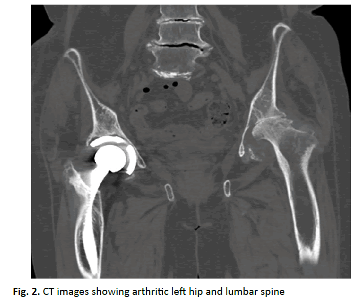orthopaedics-trauma-left-hip