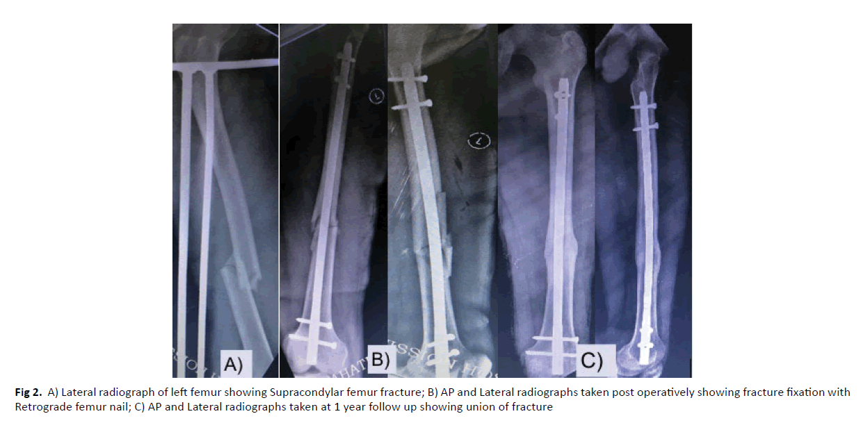 orthopaedics-trauma-surgery-fracture-fixation