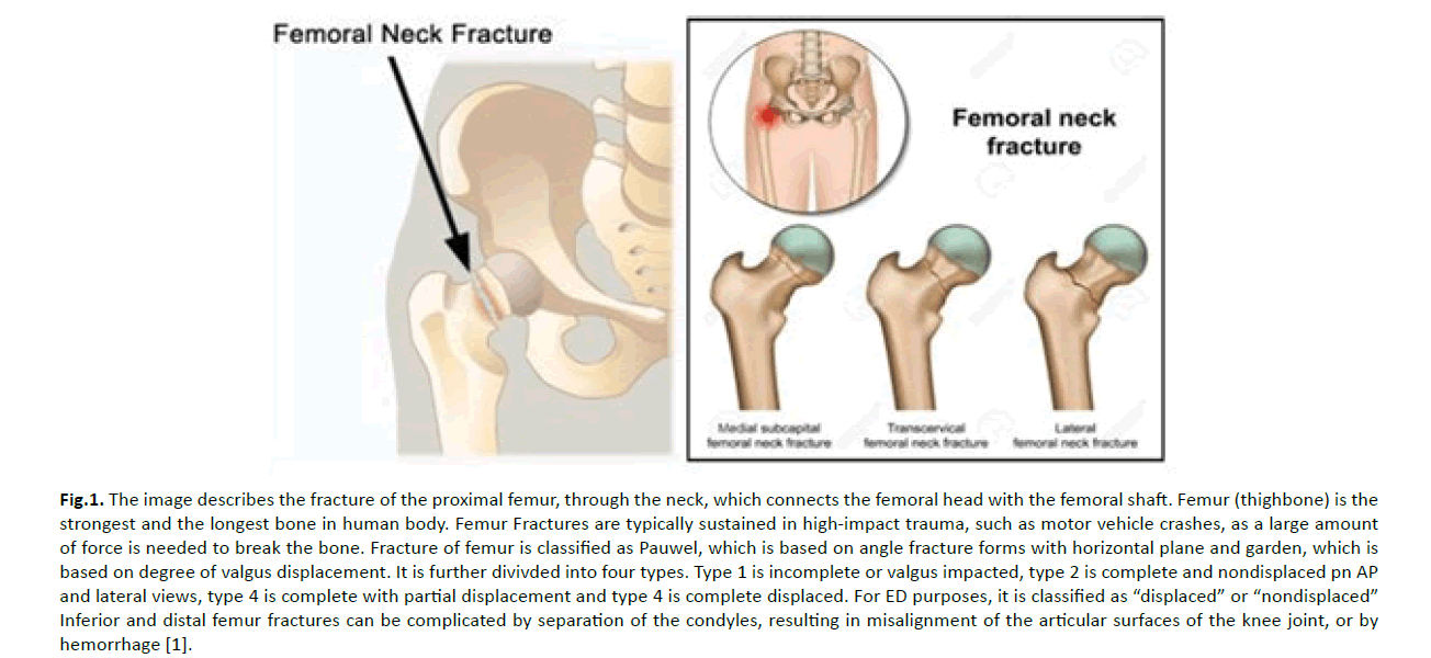 orthopaedics-trauma-surgery-proximal-femur