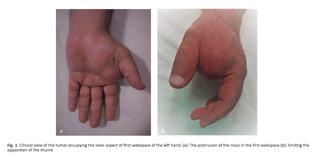 orthopaedics-trauma-tumor-occupying