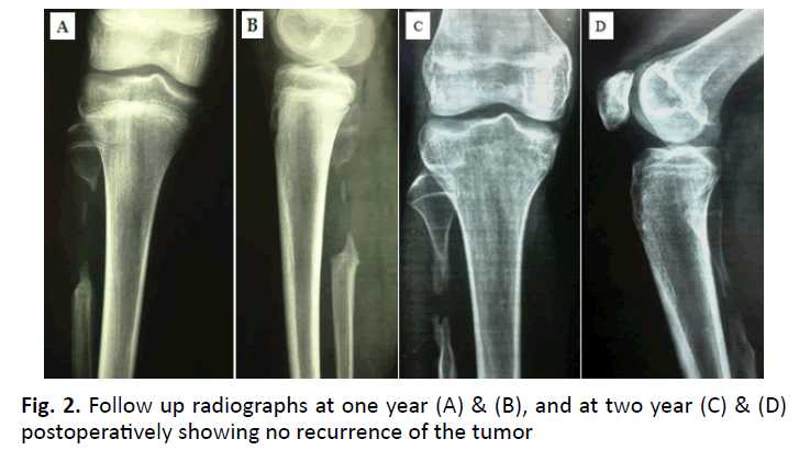 orthopaedics-trauma-two-year