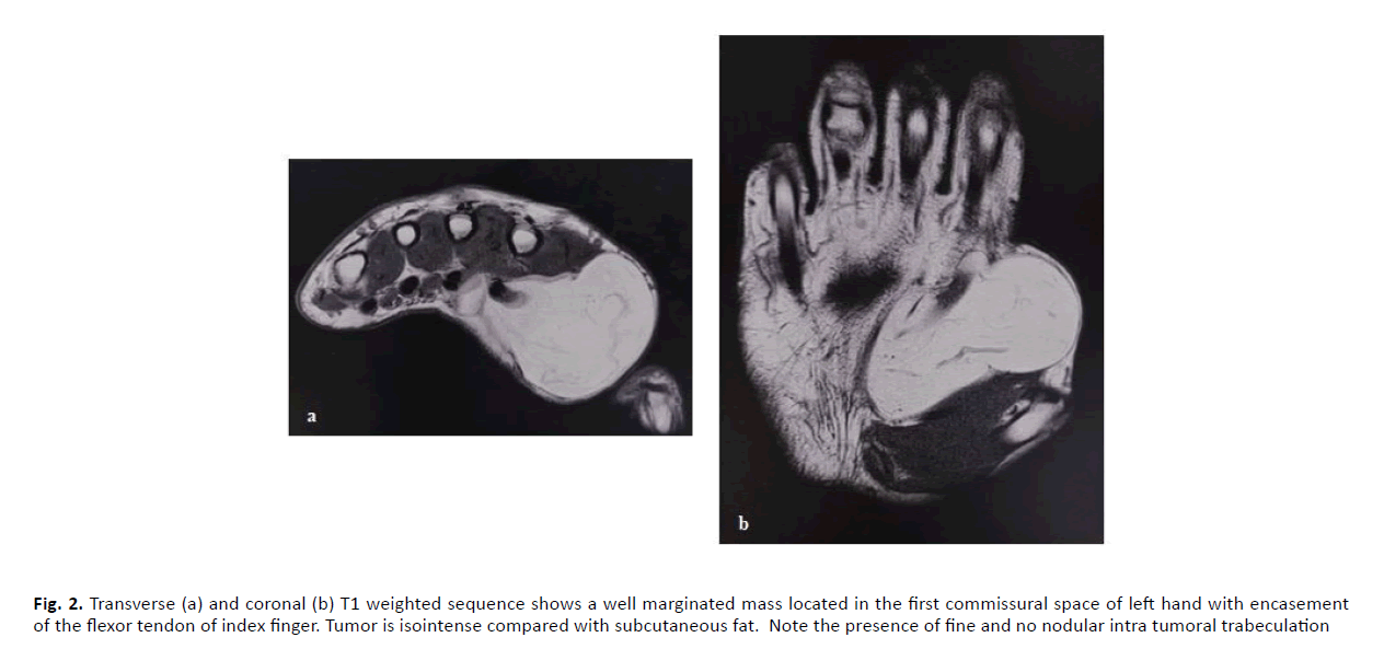 orthopaedics-trauma-weighted-sequence