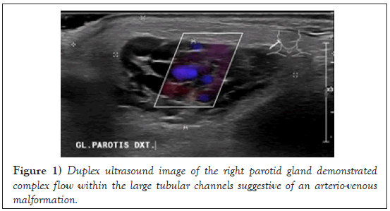 phlebology-lymphology-parotid