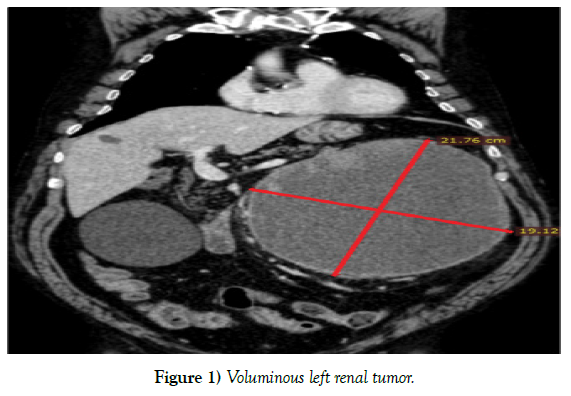 surgery-case-report-renal-tumor