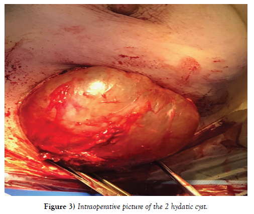 surgery-case-report-right-breast