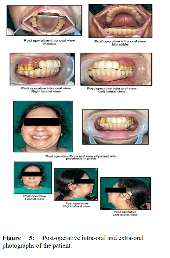 annals-post-operative
