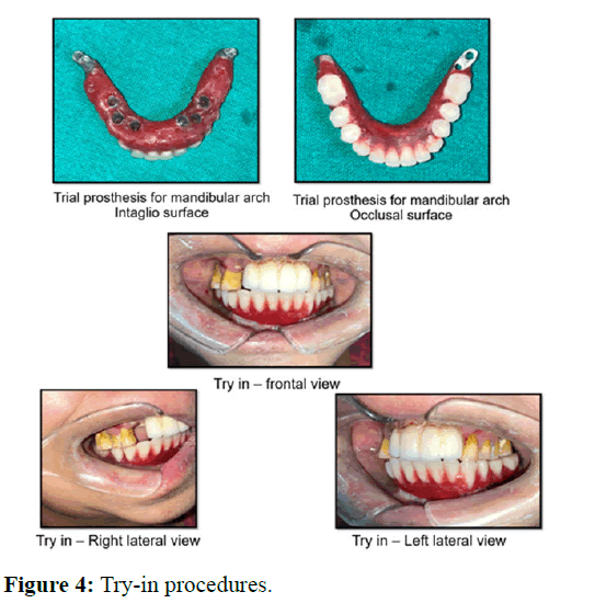 annals-procedures