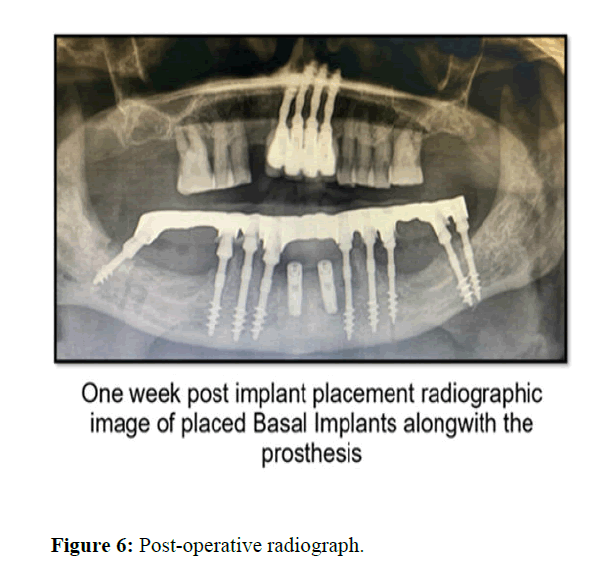 annals-radiograph