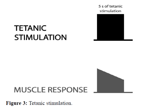 annals-tetanic