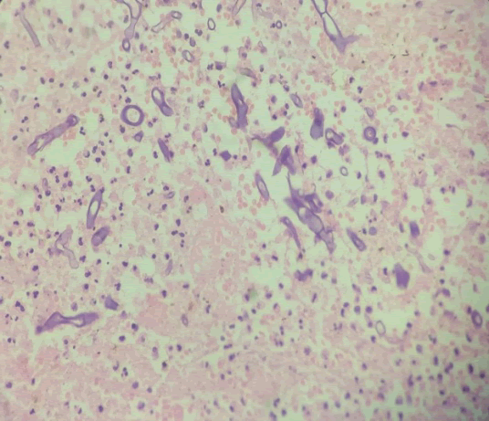 clinical-microbiology-stain