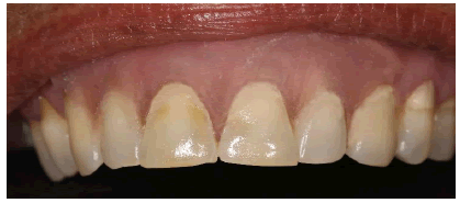 dentistry-case-Post